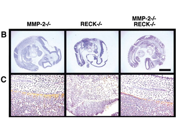 Immunohistochemistry using Collagen Type I